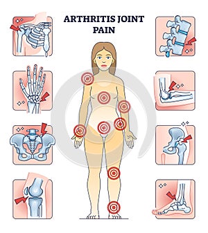 Arthritis joint pain with affected locations on human body outline diagram