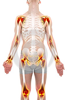 Arthritis Joints Pain Anatomy Male concept