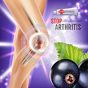 Arthritis Pain Relief Ointment ads. Vector 3d Illustration with Tube cream with blackcurrant extract.