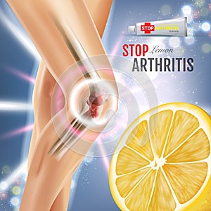 Arthritis Pain Relief Ointment ads. Vector 3d Illustration with Tube cream with lemon extract.