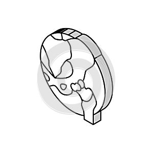 articular cartilage gout isometric icon vector illustration photo