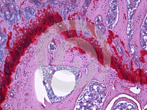 Articular Cartilage of knee joints stained with H&E photo