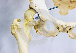 Articulated hip bone and head of femur showing human hip joint anatomy in white background