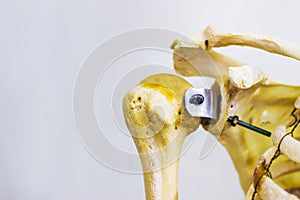 Articulated humerus clavicle and scapula bones showing human left shoulder joint anatomy in white background