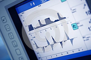 Artificail lung ventilation monitor in the intensive care unit