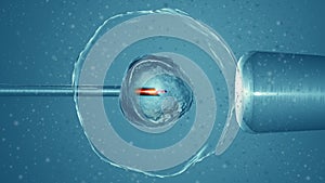 Artificial or assisted fertilization is the process by which the union of gametes is artificially carried out