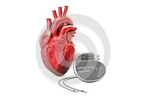 Artificial cardiac pacemaker, 3D rendering