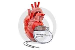 Artificial cardiac pacemaker with human heart, 3D rendering