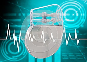 Artificial cardiac pacemaker isolated on graphic background