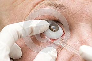 Artificial glass eye