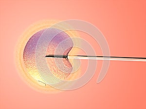 Artificial insemination photo