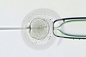 Artificial insemination by intracytoplasmic sperm injection photo