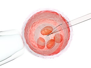 Artificial insemination or ivf