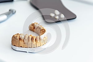 Artificial jaw with dental veneers and crowns in the dental laboratory.