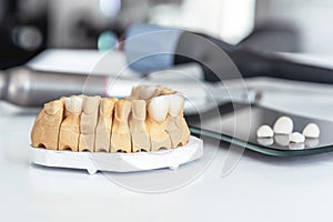 Artificial jaw with dental veneers and crowns in the office at the dentist.