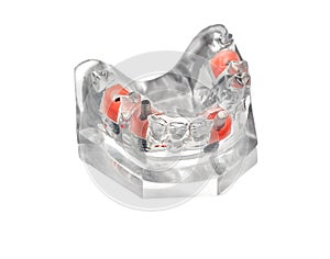 Artificial jaw