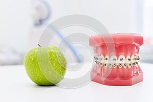 Artificial jaws with braces lie with a green apple on the table