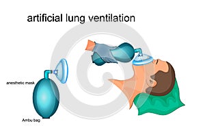 Artificial lung ventilation