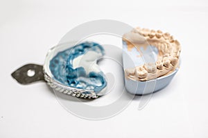 Artificial plaster jaw model with impression