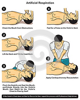 Artificial respiration steps infographic diagram