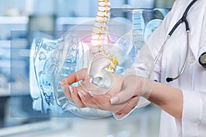 An artificial spine model with pelvis unite in doctors hands