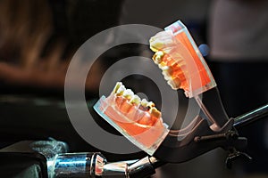 Artificial teeth made of plastic with imitation of caries. Simulator for dental practice. Dental student coaching