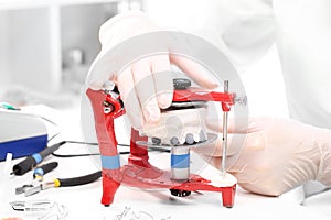 Artificial teeth, prosthetics