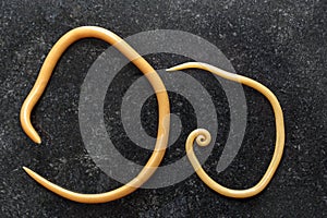 Ascariasis is a disease caused by the parasitic roundworm Ascaris lumbricoides for education.