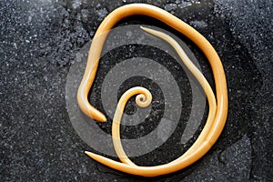 Ascariasis is a disease caused by the parasitic roundworm Ascaris lumbricoides for education.