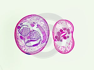 Ascaris comparative cross sections 20X