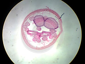 ASCARIS FEMALE Ã¯Â¼Åroundworm photo