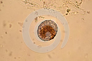 Ascaris lumbricoides photo