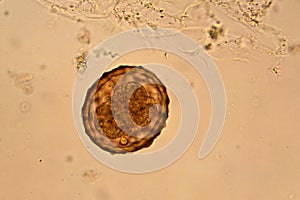 Ascaris lumbricoides photo