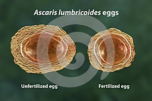 Ascaris lumbricoides eggs, illustration