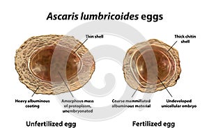 Ascaris lumbricoides eggs, illustration