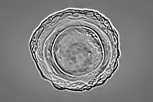 Ascaris lumbricoides fertilized egg, illustration