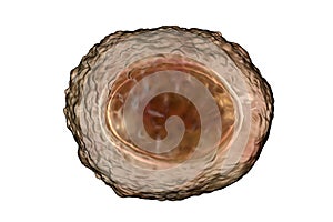 Ascaris lumbricoides unfertilized egg, illustration