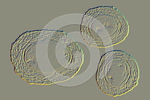 Ascaris lumbricoides unfertilized egg, illustration