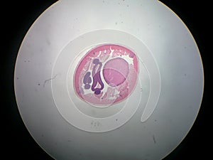 ASCARIS male Ã¯Â¼Åroundworm photo