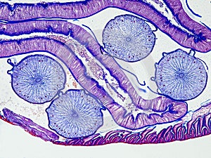 Ascaris megalocephala cross section under the microscope showing its cuticle, intestine and ovaries - optical microscope x100