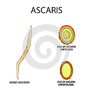 Ascaris the structure of an adult. Fertilized and unfertilized egg. The structure of the egg ascarids. Set. Infographics.