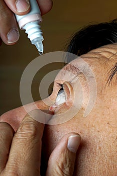 Asia man use medicine eyedropper