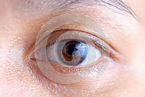 Asia woman eye macro, the vision of the future and healthy life concept. view precise and straight to the target concept