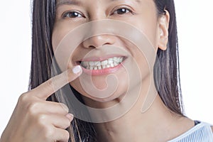 Asian American Woman pointing her perfect white Teeth