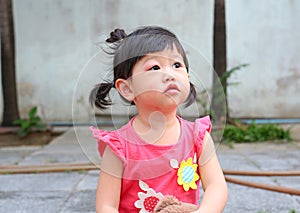 Asian baby girl eye swell