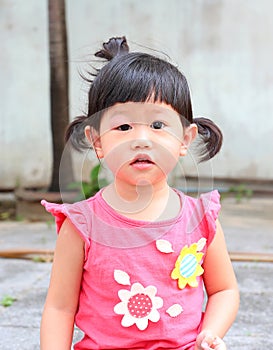 Asian baby girl eye swell