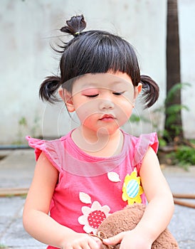 Asian baby girl eye swell