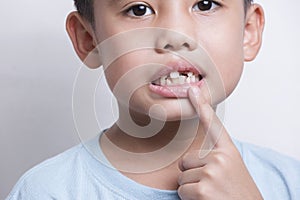 asian boy face looking at tooth and showing teeth behind on white background