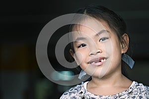 Asian child girl missing front tooth, smiling face. Close up to cute face, space for copy and design. Eyes looking at camera