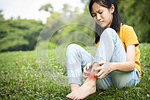 Asian child girl scratching itch on her leg with hand,female teenage with red rash,mosquito bite,fungal infection,insect bites,